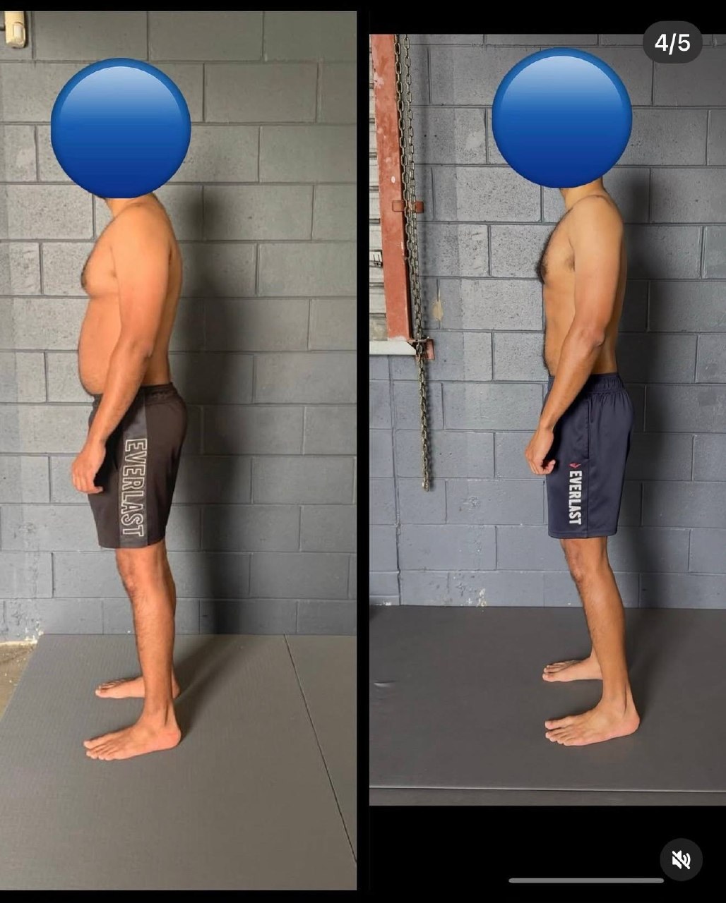 Anterior Pelvic Tilt Fix — What Actually Works — image 2