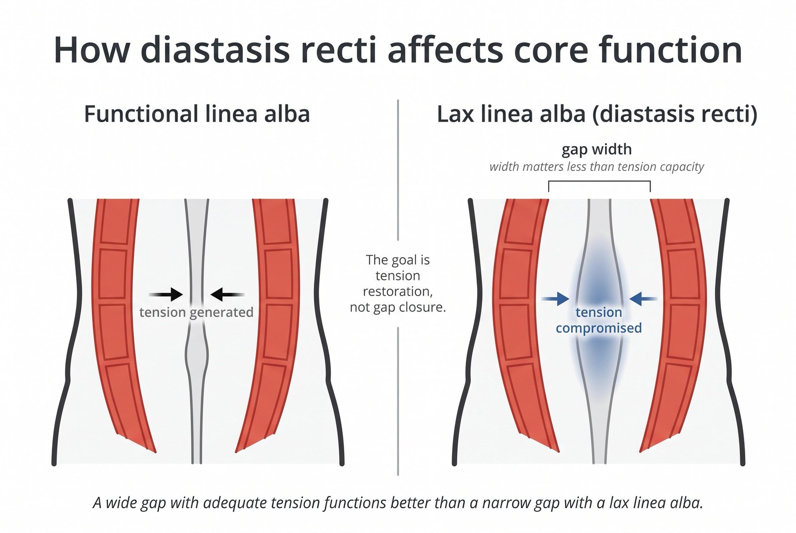 Diastasis Recti Postpartum — Can It Still Close and What Actually Works