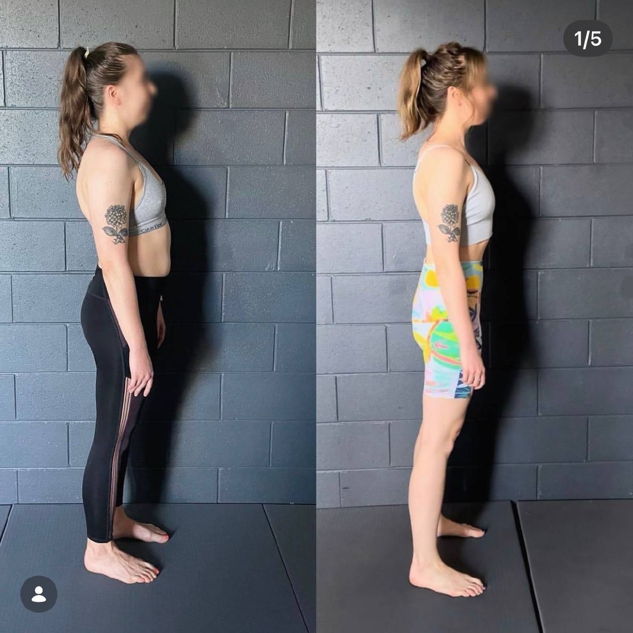 Double Jointed Shoulders: What Hypermobility Really Means for Your Body — image 1