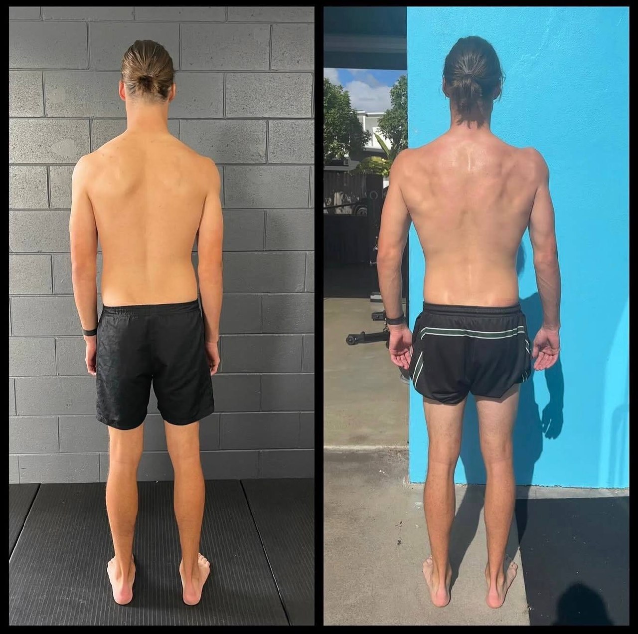 Double Jointed Shoulders: What Hypermobility Really Means for Your Body — image 3