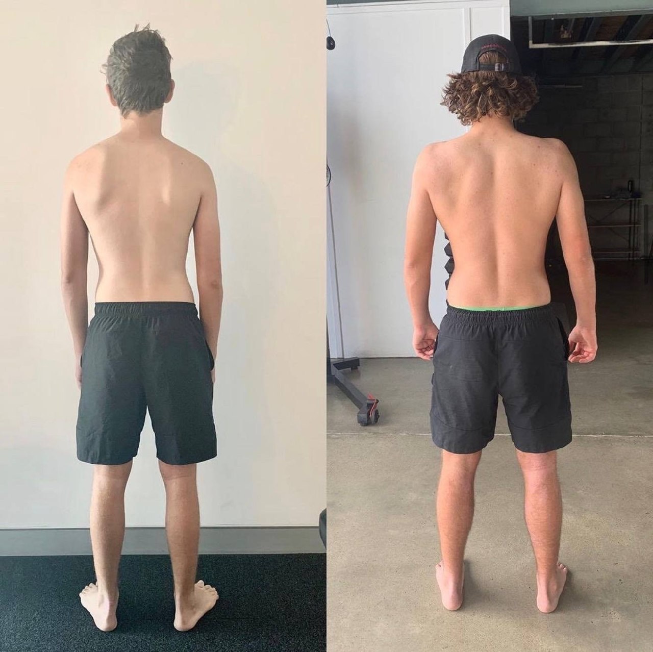 Double Jointed Shoulders: What Hypermobility Really Means for Your Body — image 4