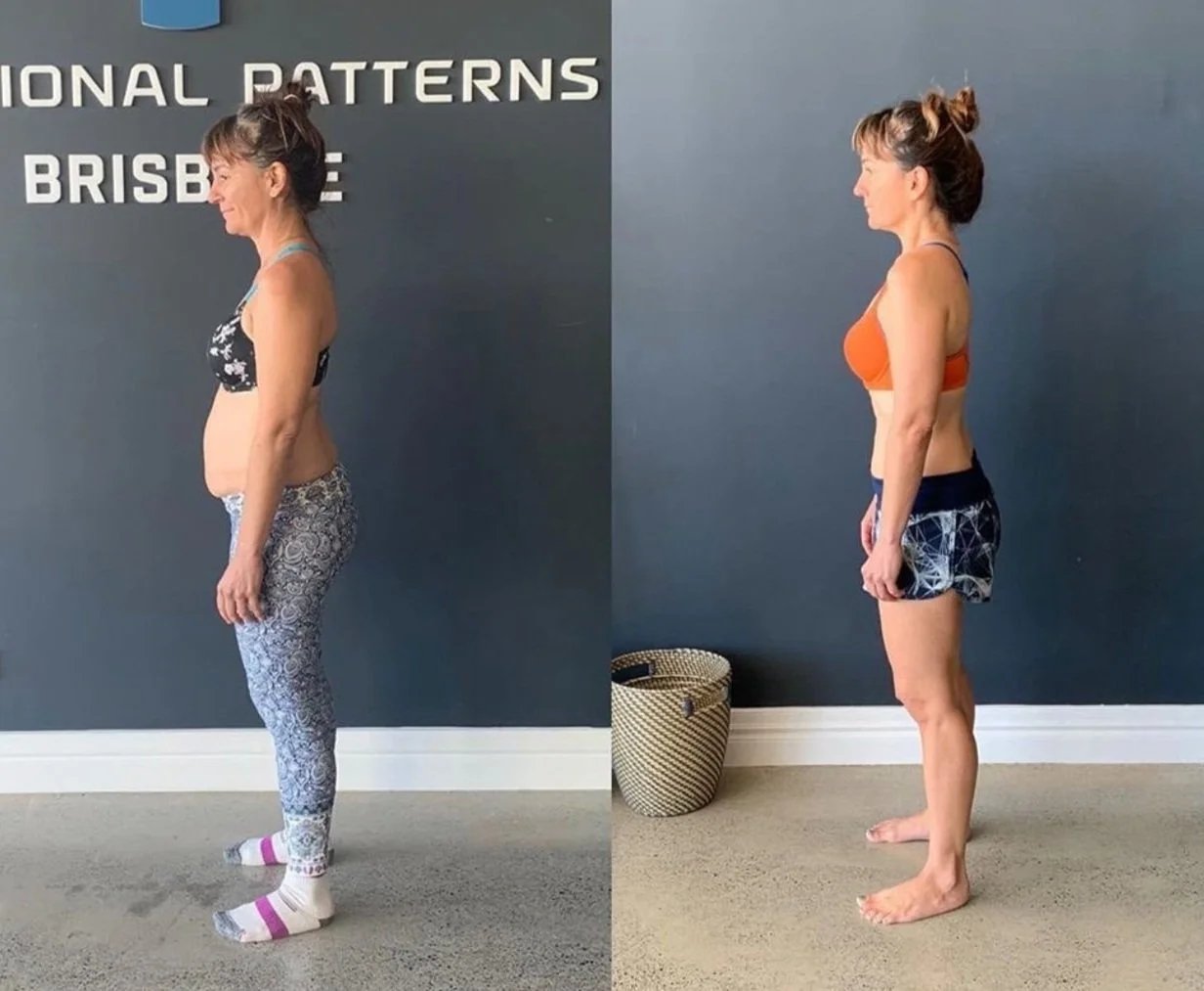 Fascia & Chronic Pain: The Cause & The Cure 