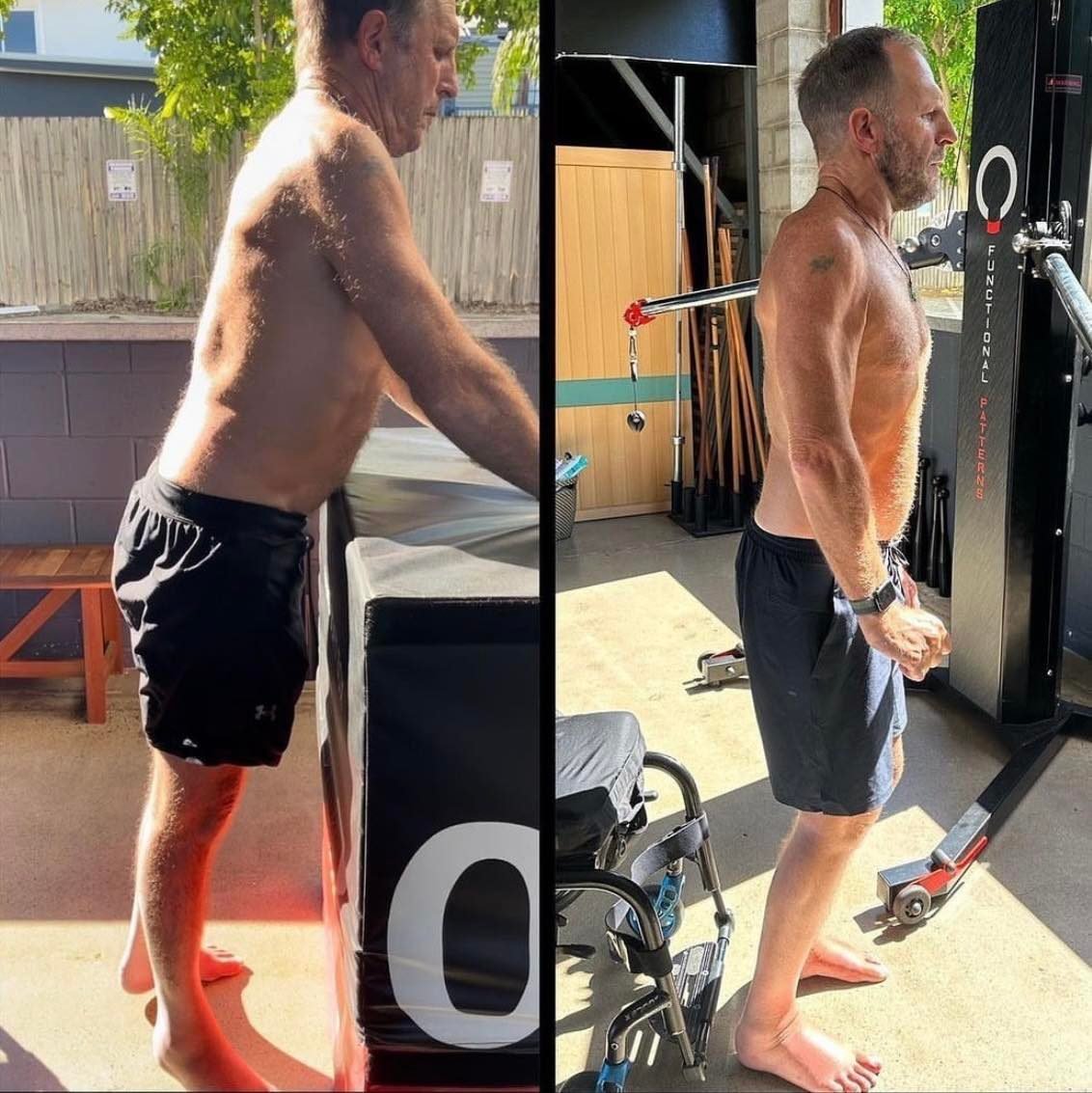 Fascia and Biomechanics - A Neuro-Endocrine Organ