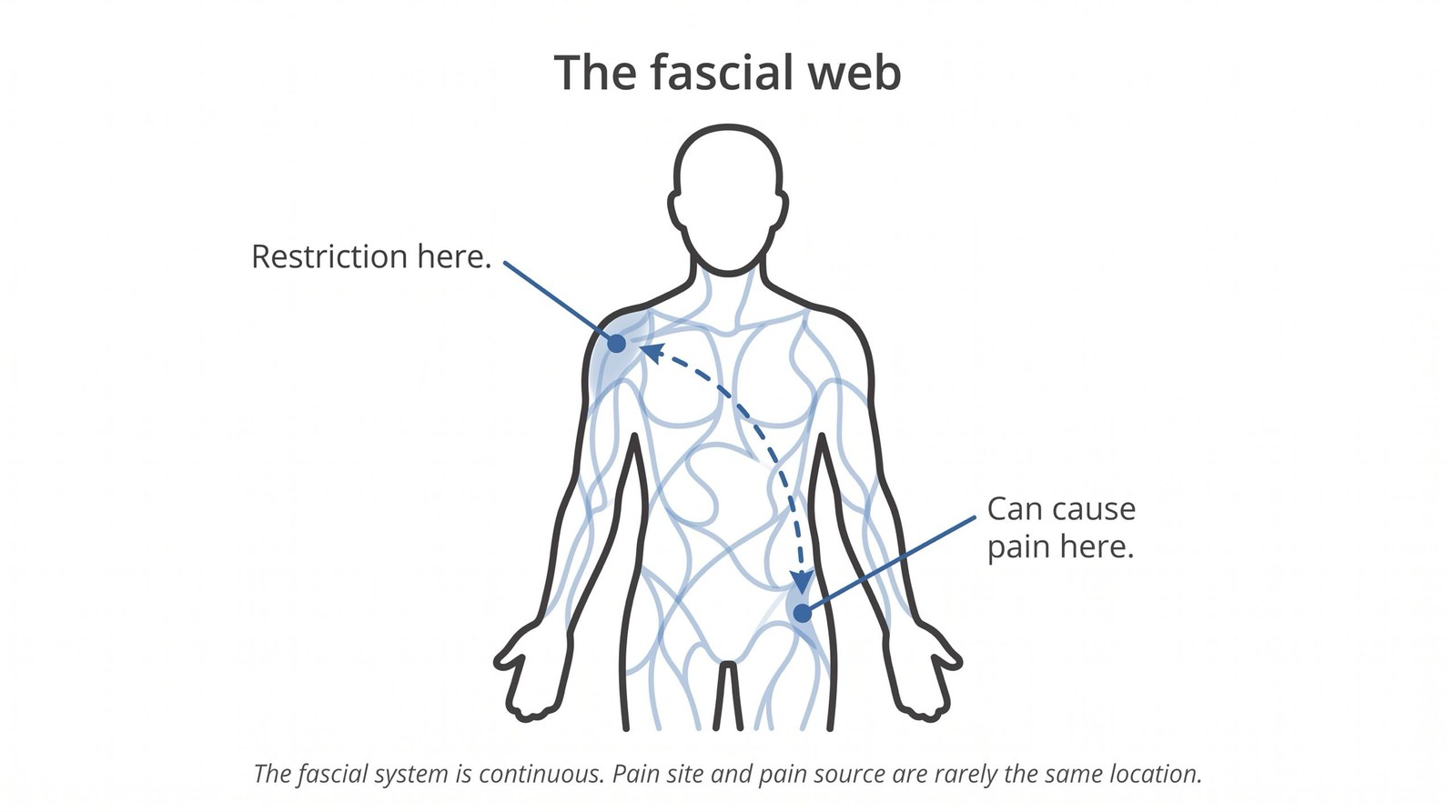Fascia and Chronic Pain: The Connection Mainstream Medicine Keeps Missing