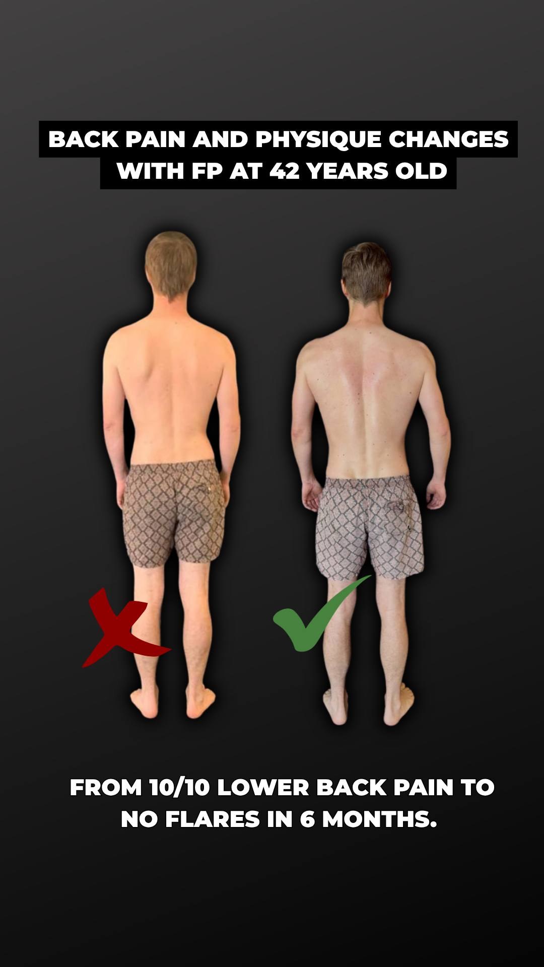 Frozen Shoulder Root Cause — Why Your Shoulder Locked Up and How to Actually Fix It
