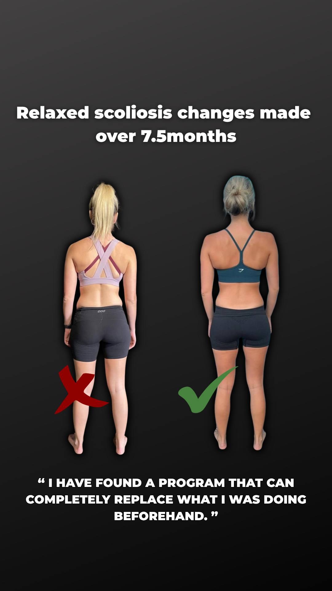Frozen Shoulder Root Cause — Why Your Shoulder Locked Up and How to Actually Fix It — image 2