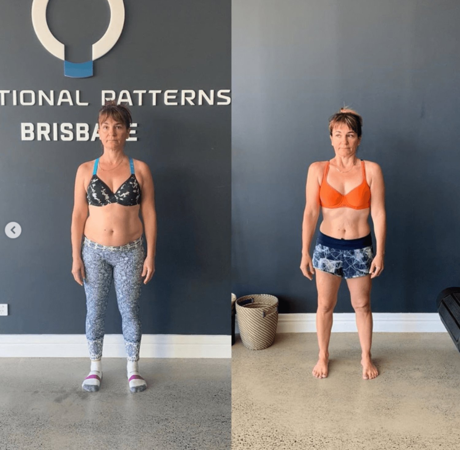 Elbow Pain: A Permanent Solution in Brisbane