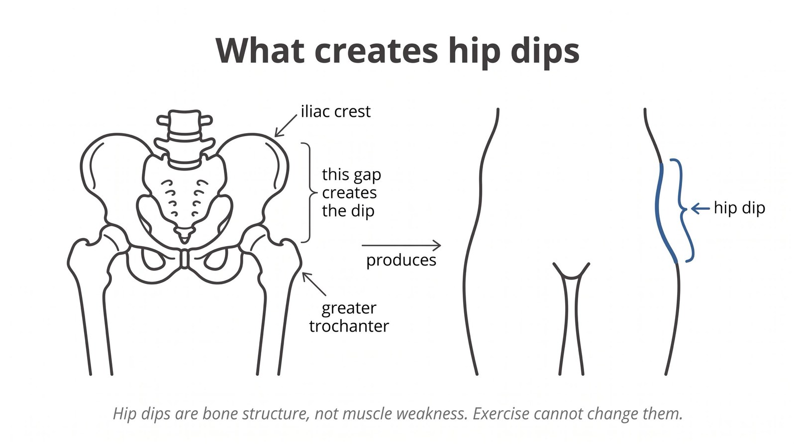 Hip Dips Are Structural, Not a Workout Problem: But Here's What Actually Matters About Your Hips