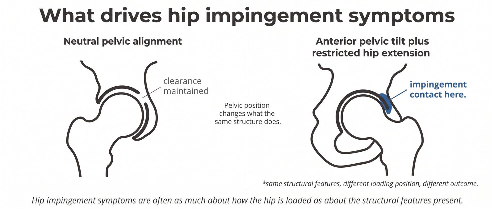 Hip Impingement Without Surgery — What Actually Helps