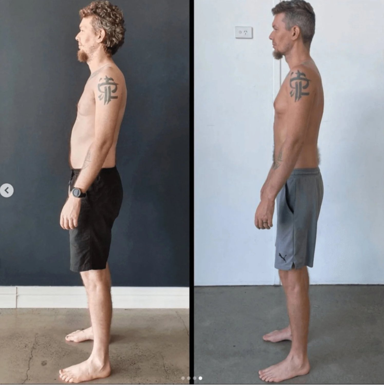 posture correction functional patterns