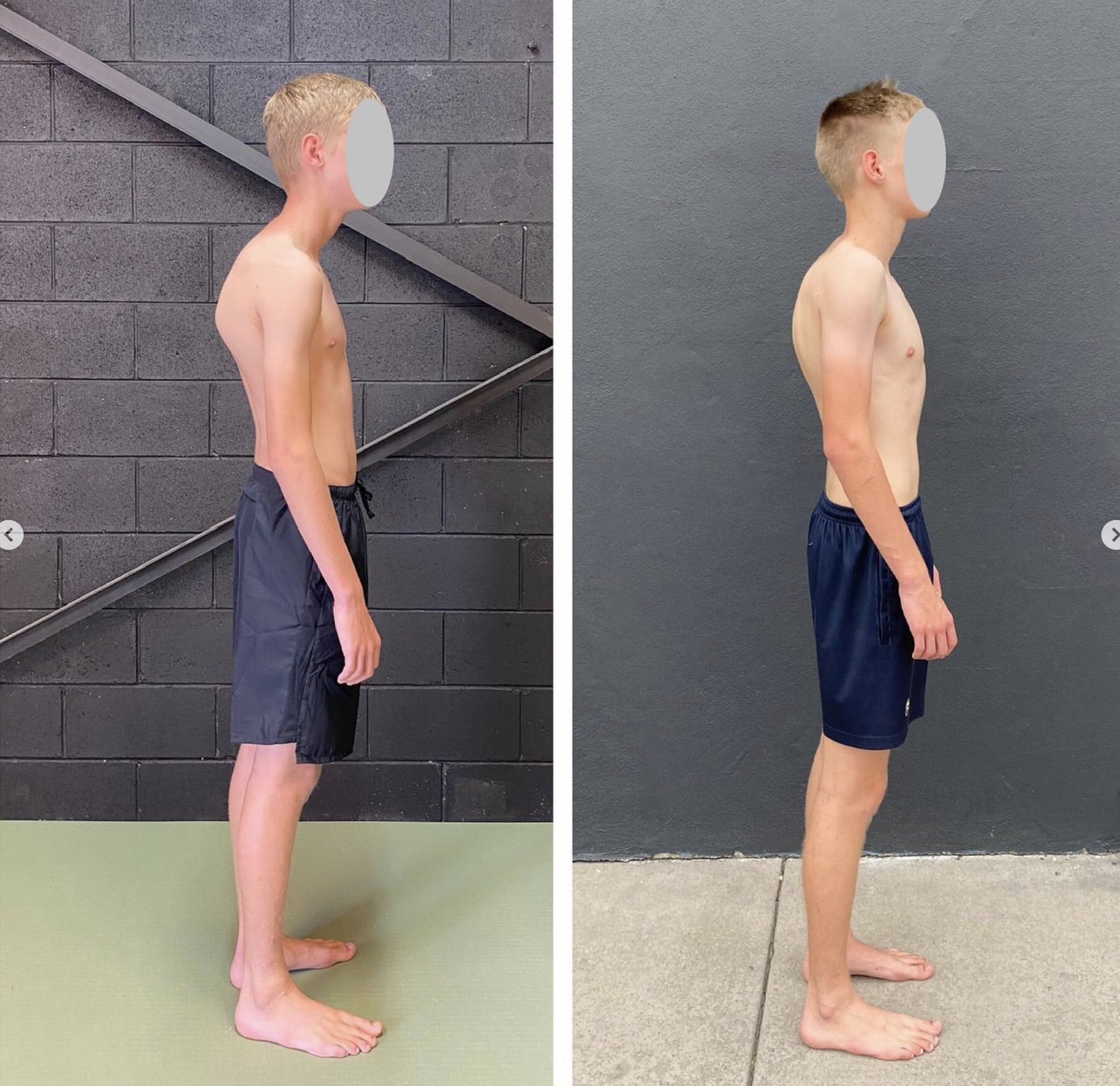 posture specialist Brisbane