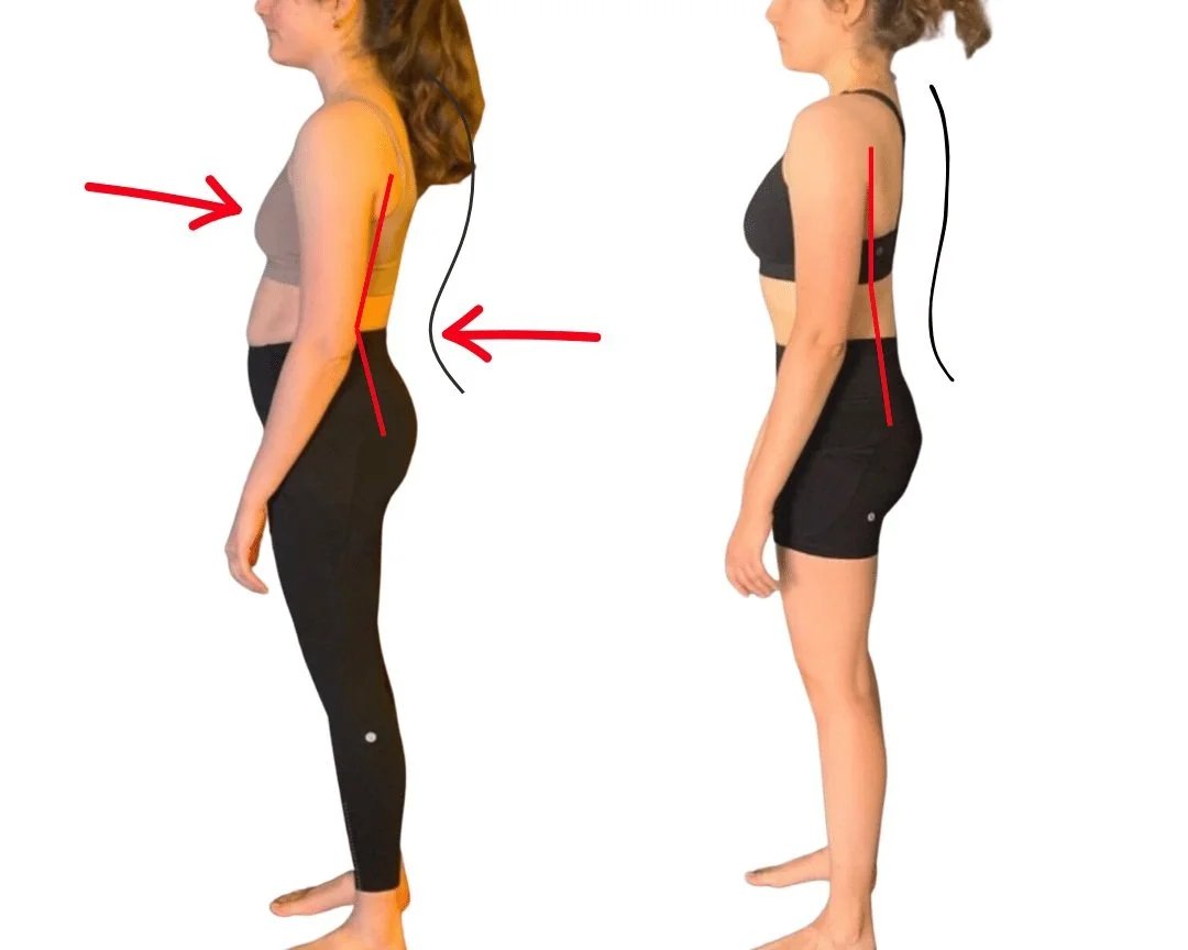 Fp web graphics 2 — How to Fix a Kyphosis and Lordosis Naturally