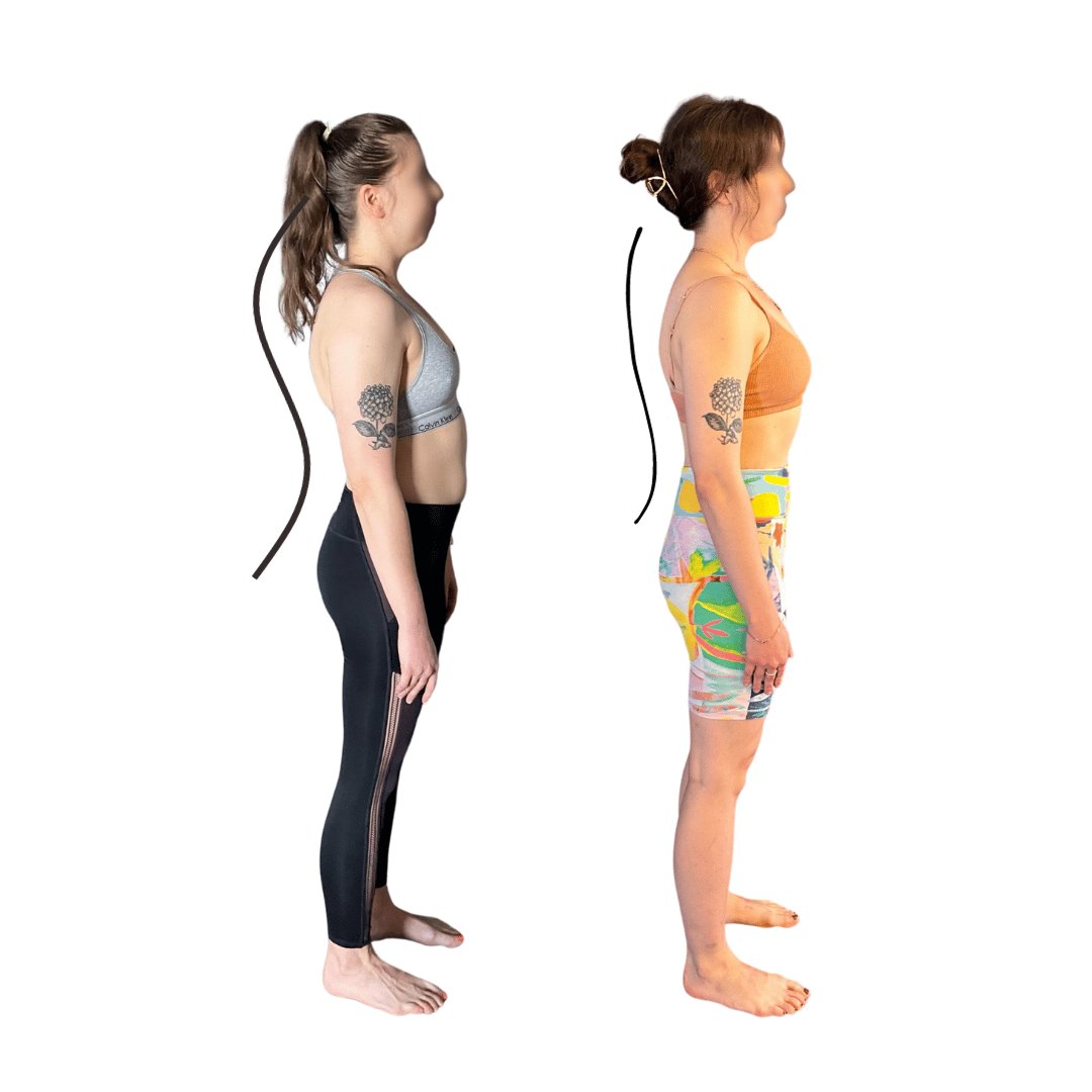 Fp web graphics 8 — How to Fix a Kyphosis and Lordosis Naturally