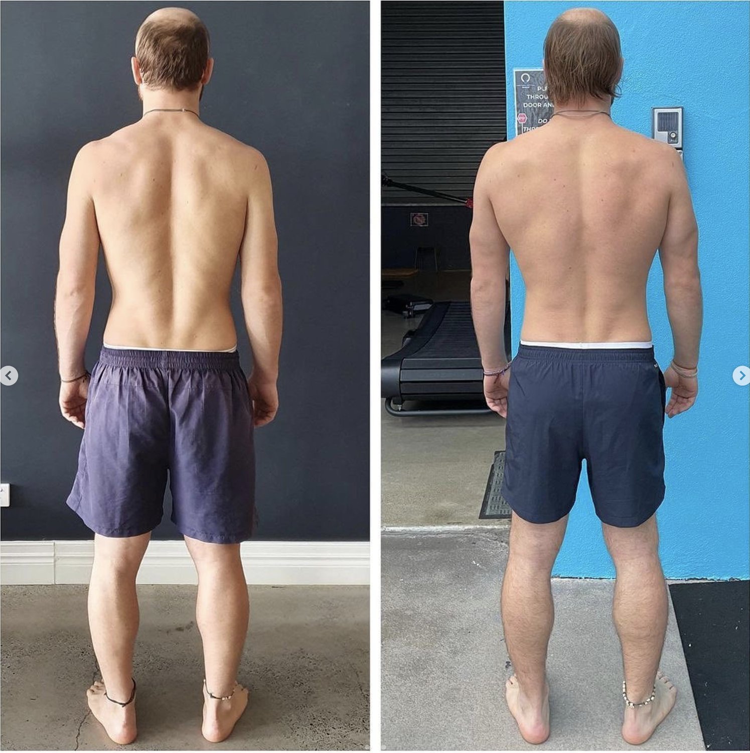 how to heal a bulged disc naturally