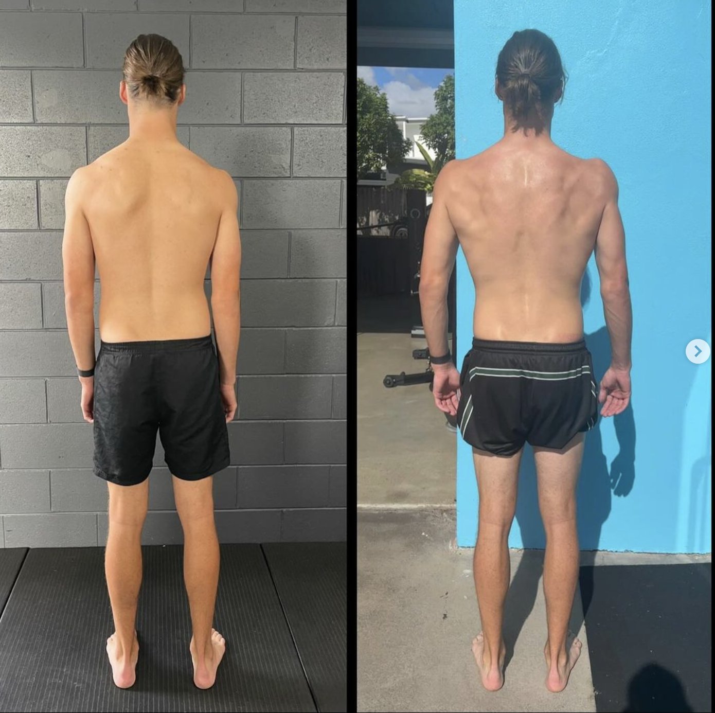 back pain specialist brisbane