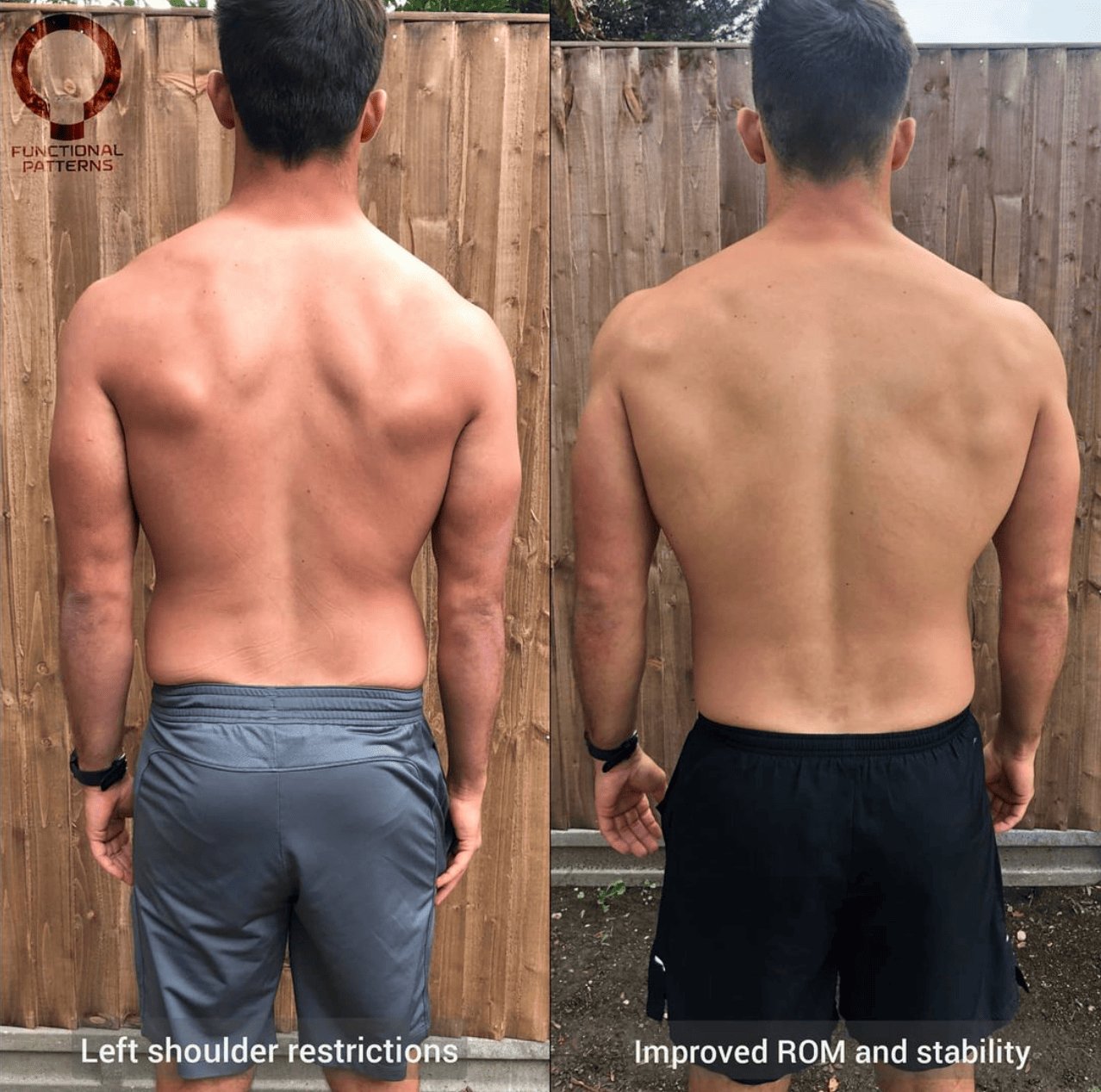 chronic back pain specialist brisbane