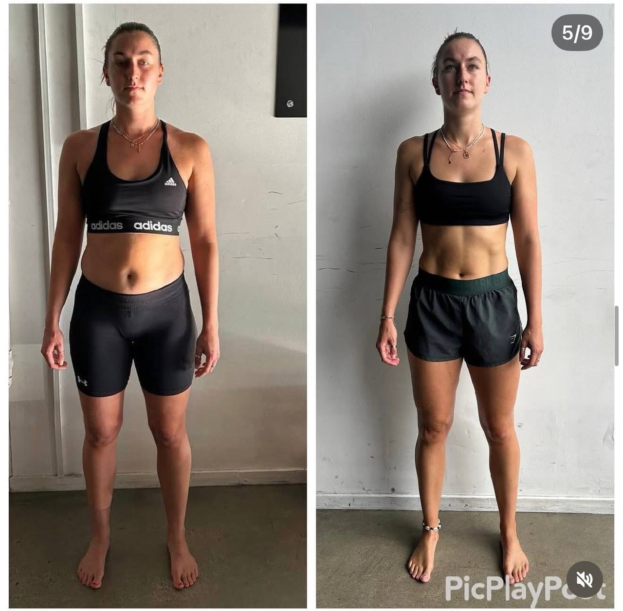 Mechanotransduction: The Missing Link Between How You Move and How Your Body Heals