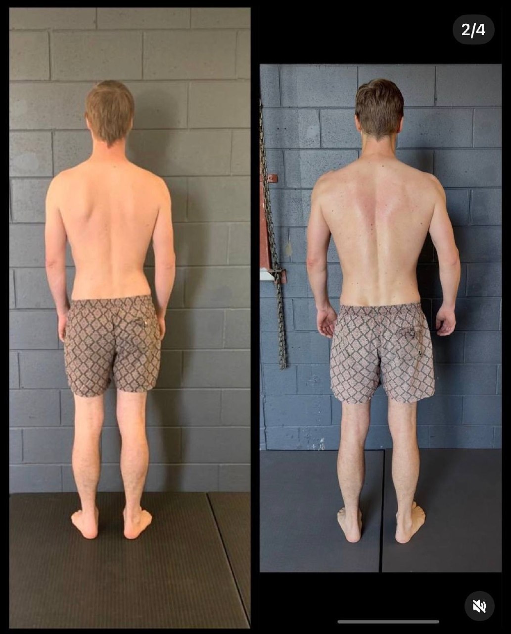 One Shoulder Sits Higher Than The Other (And How To Fix It) — image 3