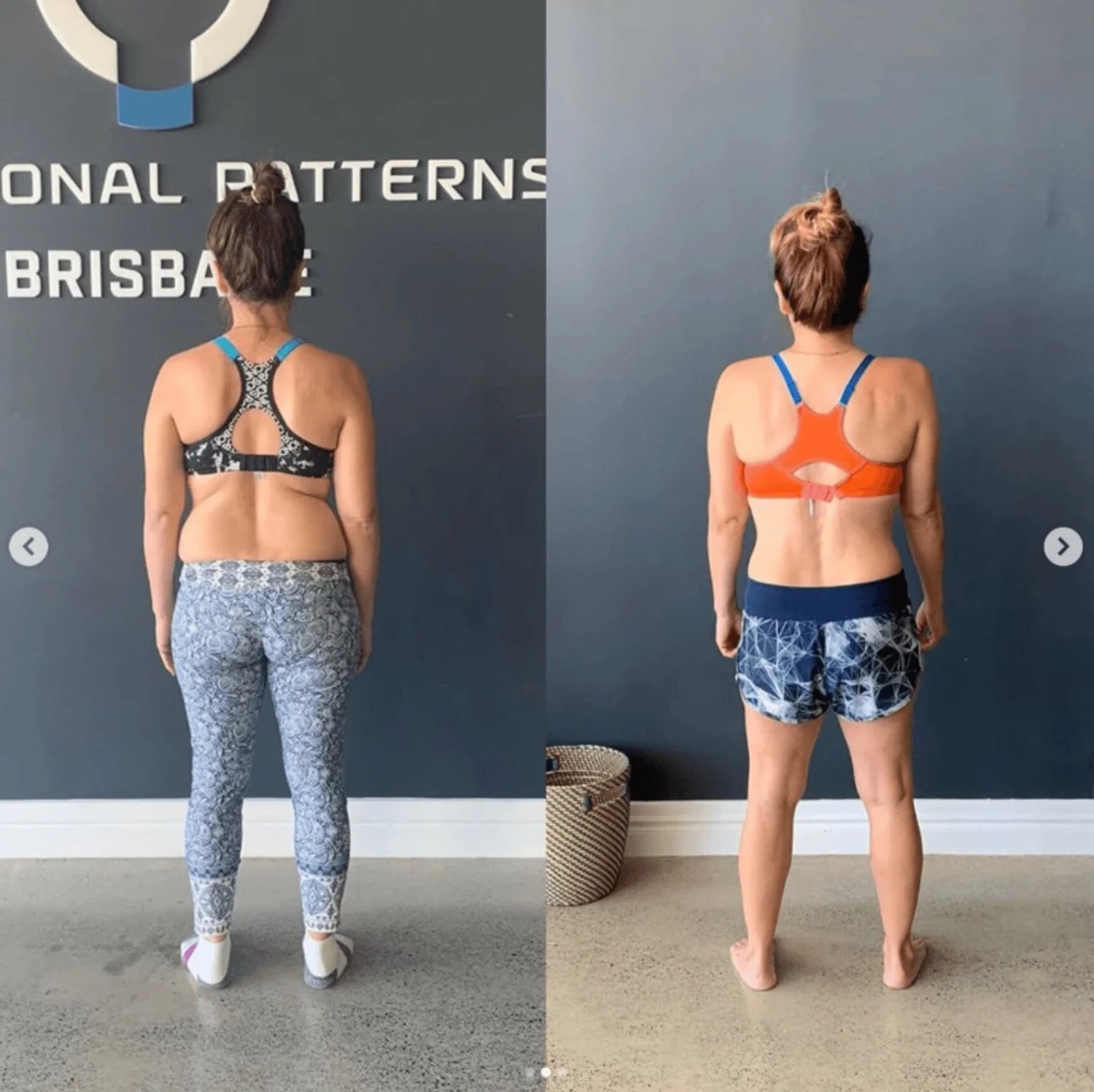 Read this if your lower back hurts when walking or standing