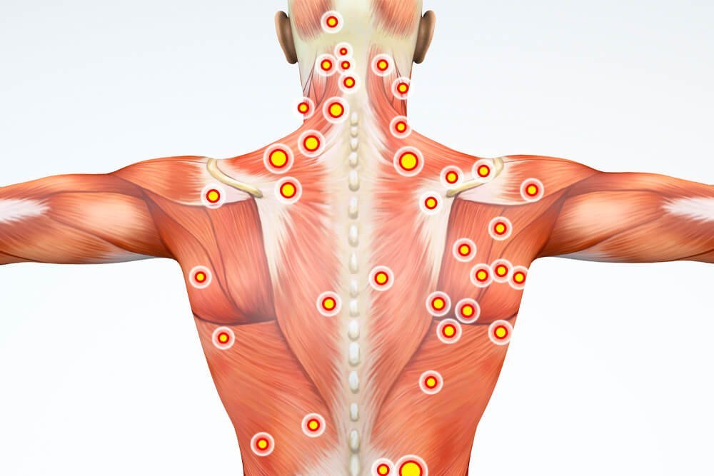 Reversing Scoliosis Naturally: A Step-by-Step Case Study & Guide