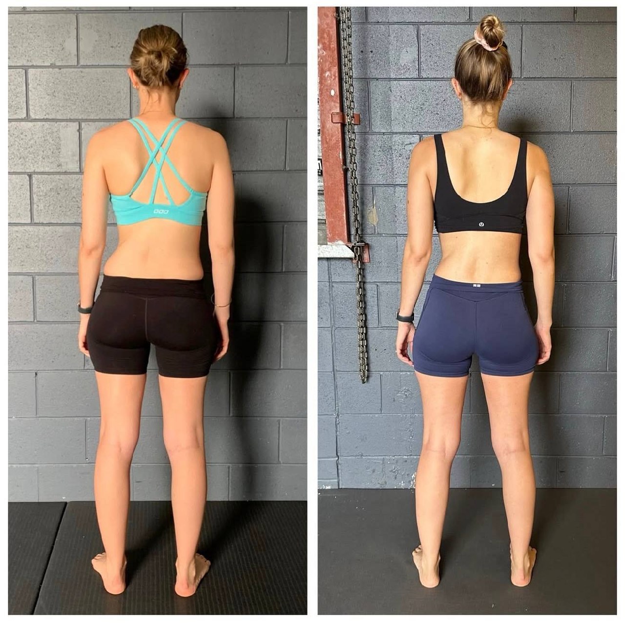 SCAPULAR WINGING: WHY EXERCISES ALONE WON’T FIX IT (AND WHAT WILL) — image 1