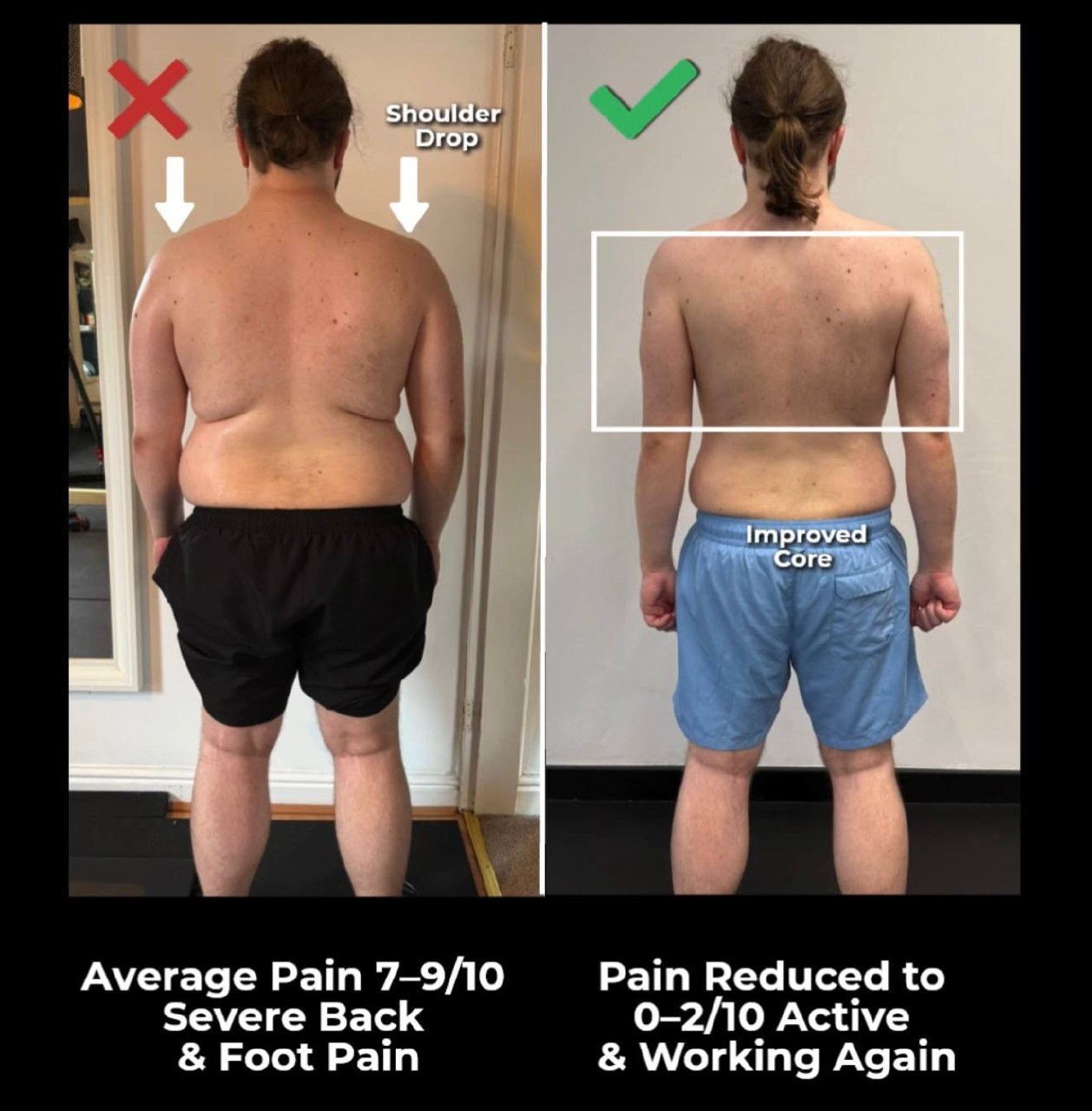 Sciatica Root Cause — Why the Pain Down Your Leg Isn’t Coming From Where You Think — image 2