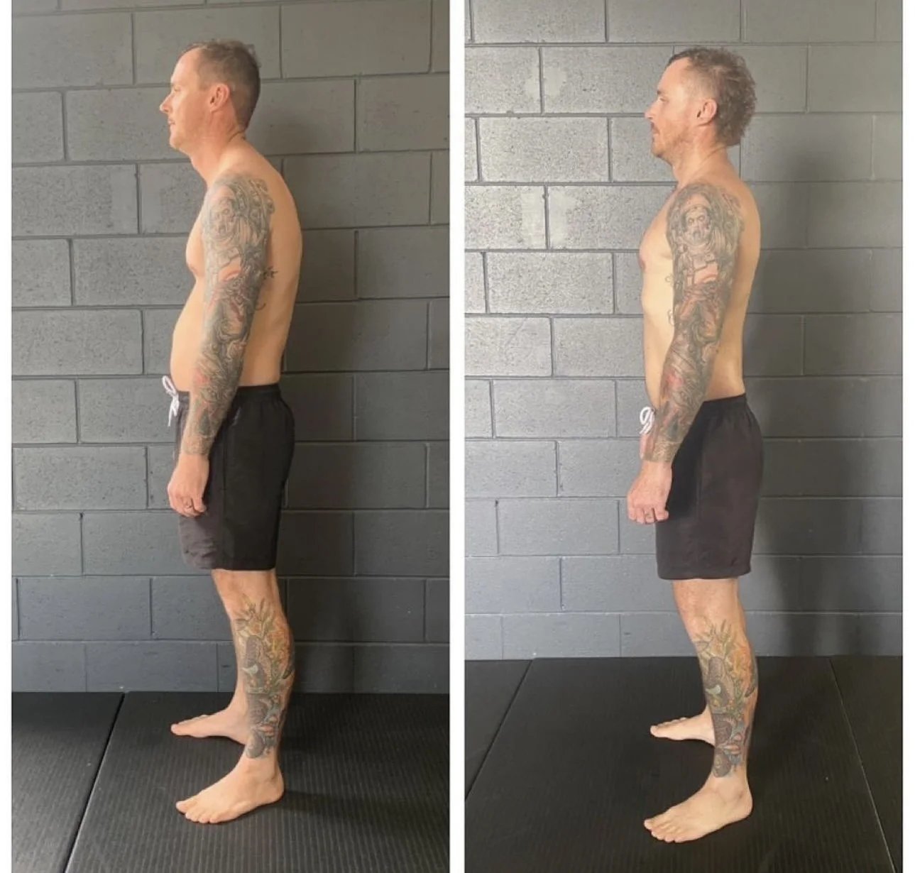 kyphosis and shoulder mobility