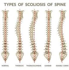 Download — Thoracolumbar Spinal Curvature: What It Means, Why It Happens, and How to Improve Movement