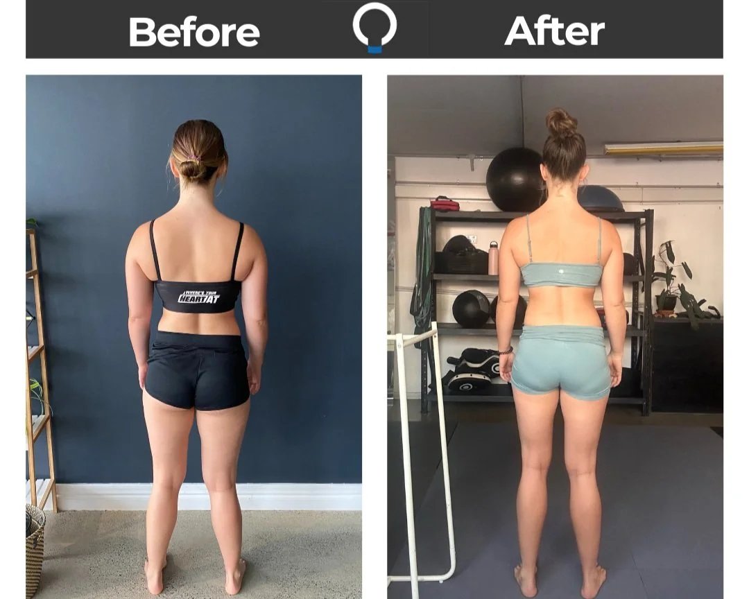 exercises for hypermobility