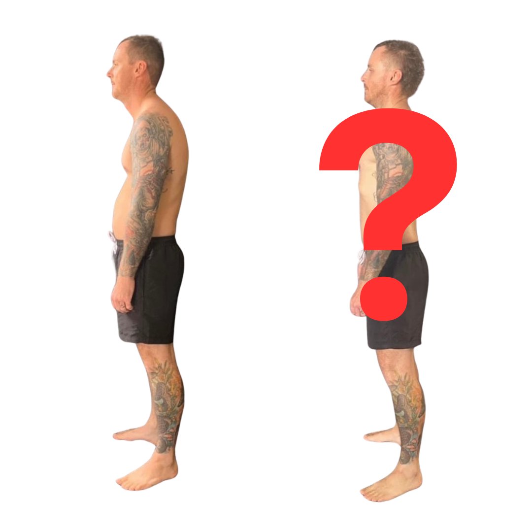 Understanding Poor Posture: A Comprehensive Guide
