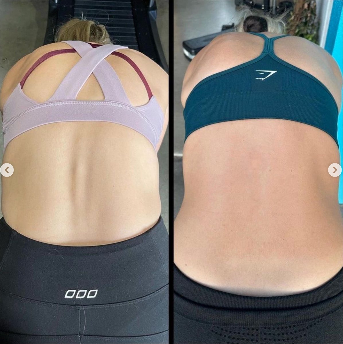 Screen shot 2023 05 11 at 8 56 38 am — Unlocking Balanced Movement: A Holistic Approach to Understanding and Addressing Scoliosis