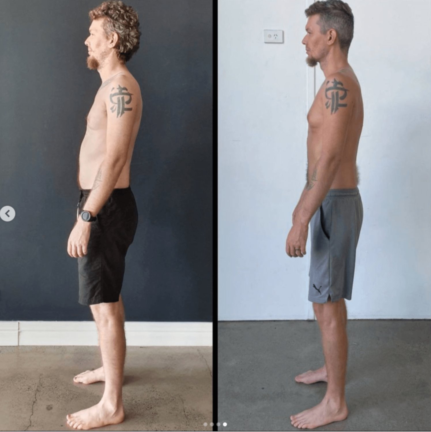 What is Chronic Pain Syndrome