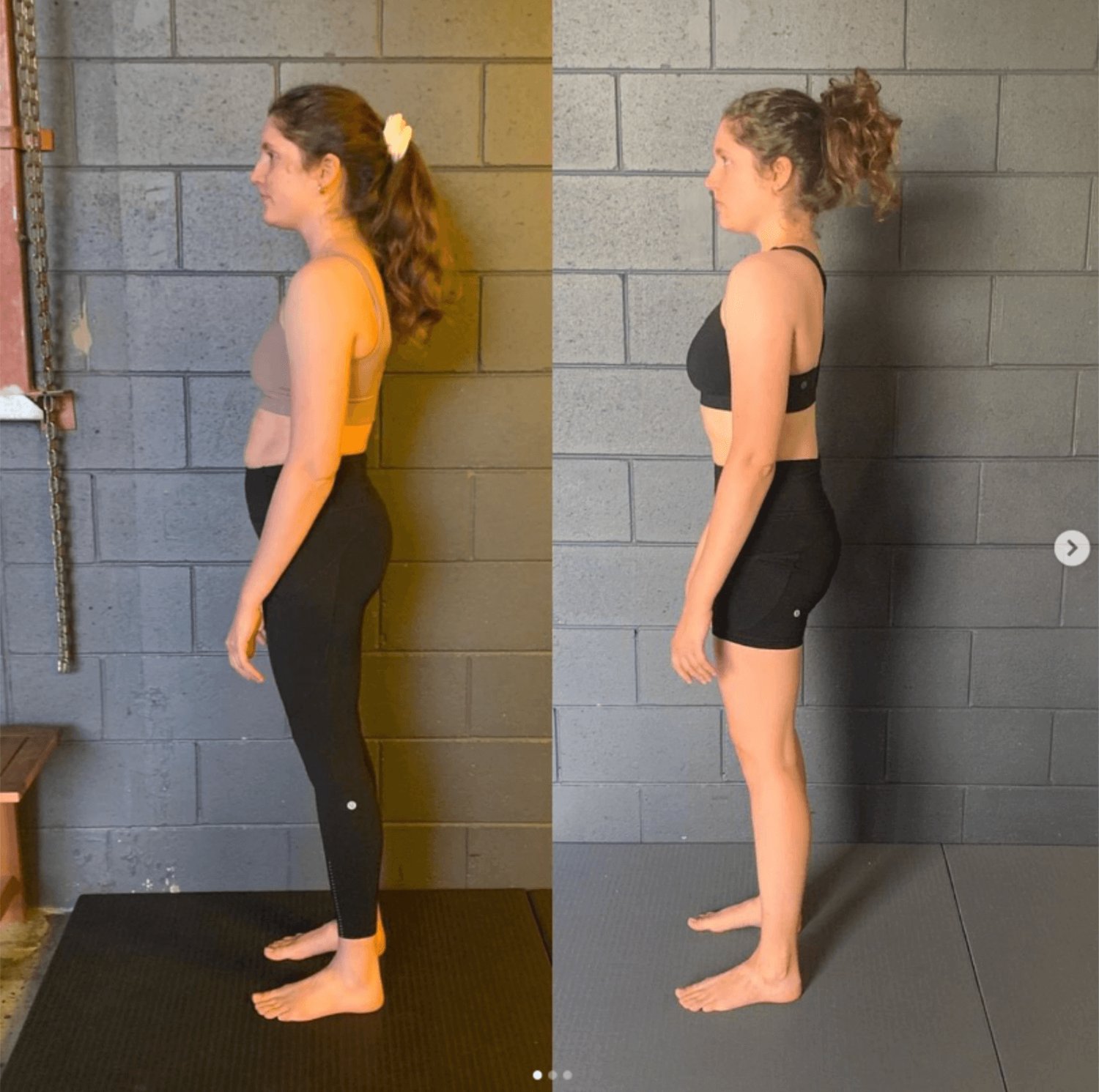 Why A Knee Hyperextension Brace Is Not The Answer