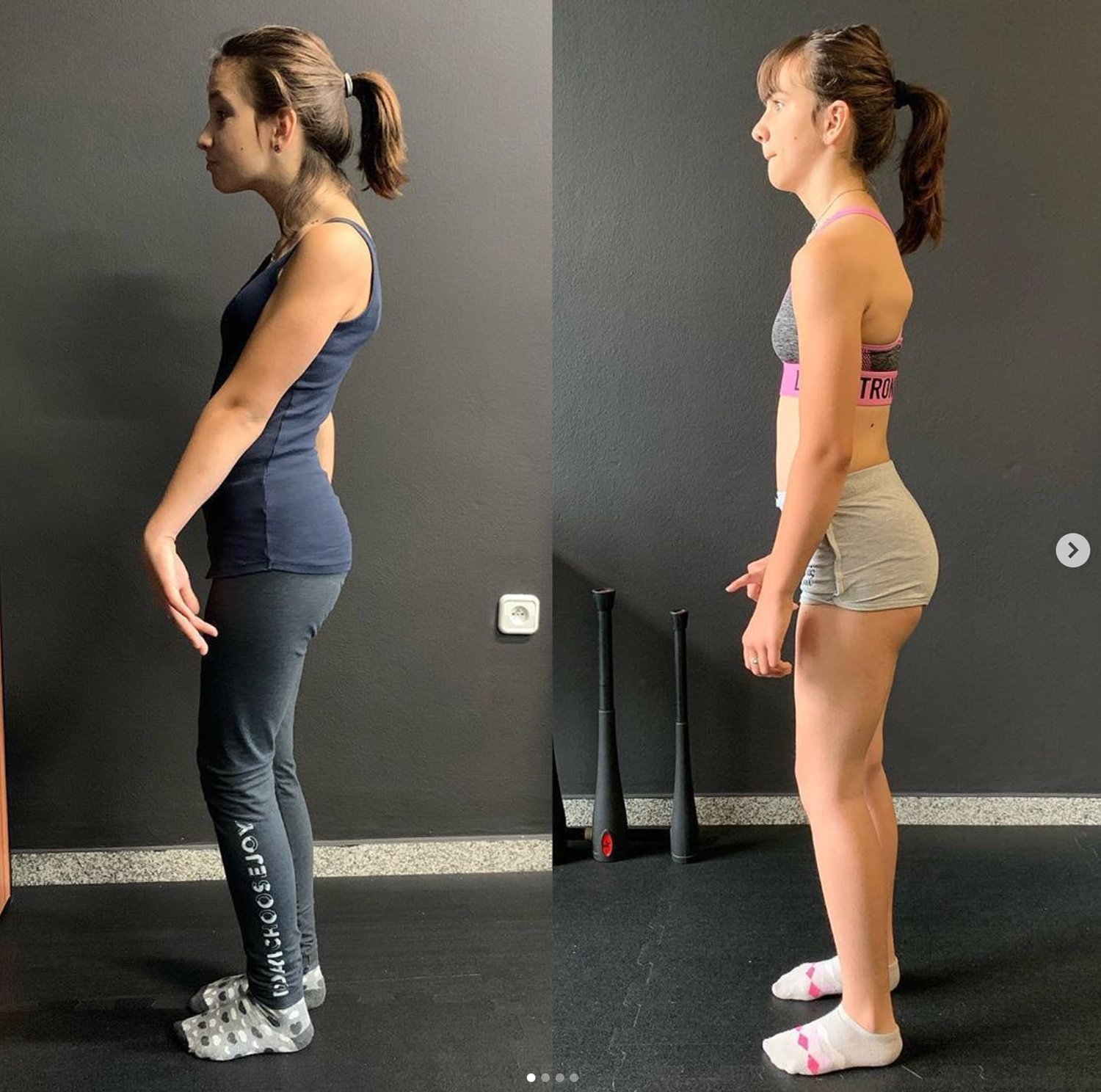 Why Kids & Teenagers Should Get A Gait/Running Analysis 