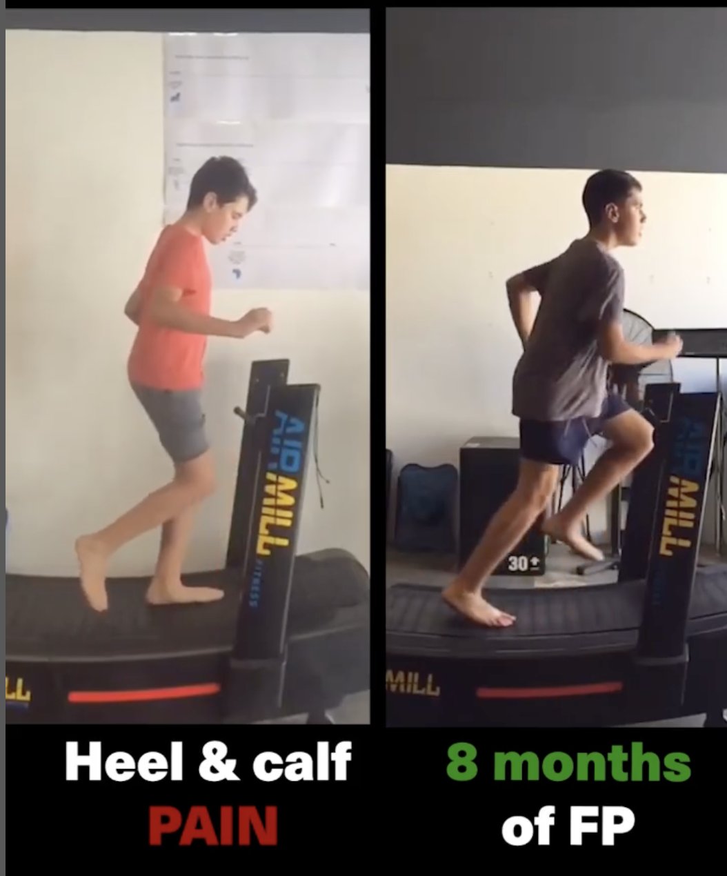 Why Kids & Teenagers Should Get A Gait/Running Analysis