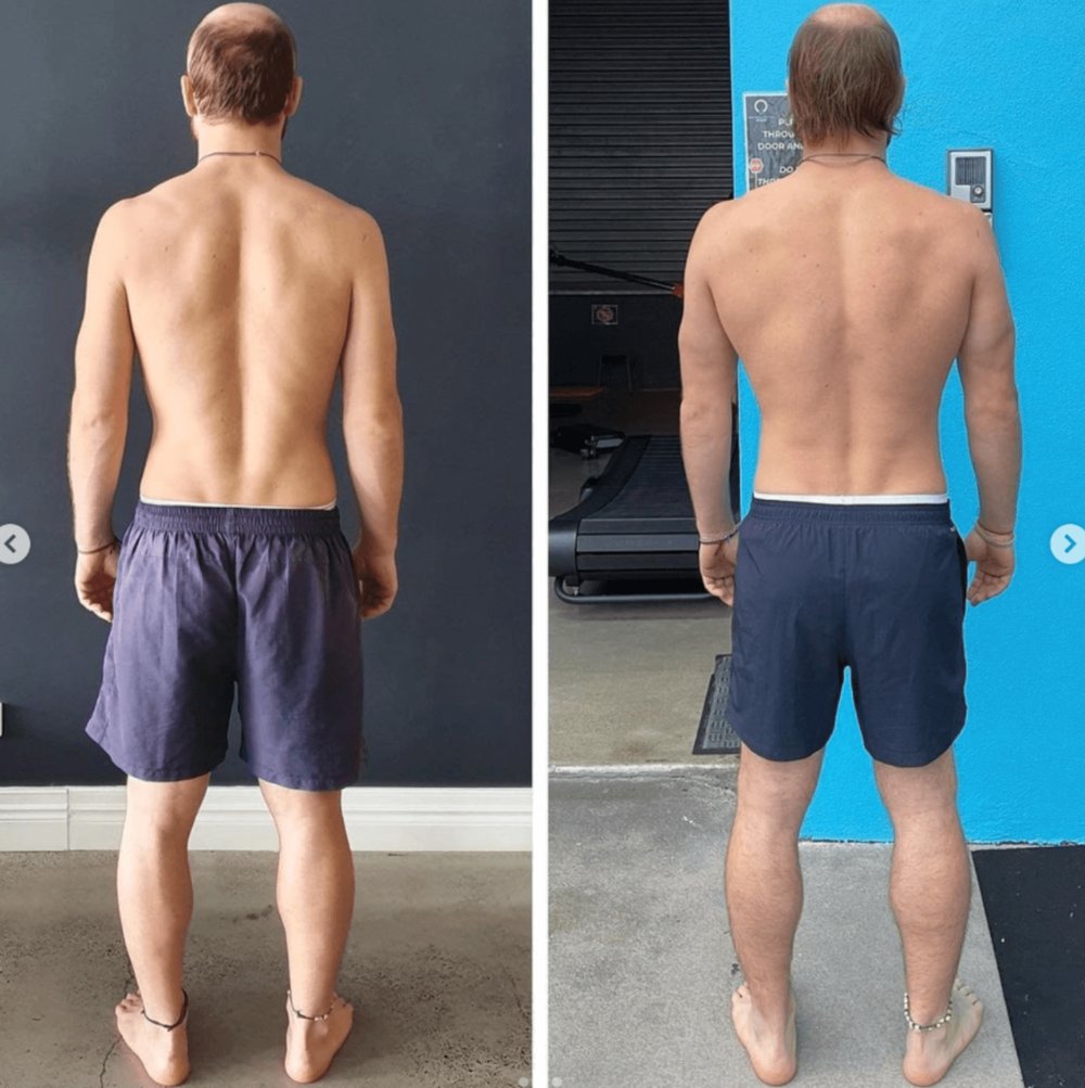 Why Stretching and Strengthening Alone Don’t Fix Pain