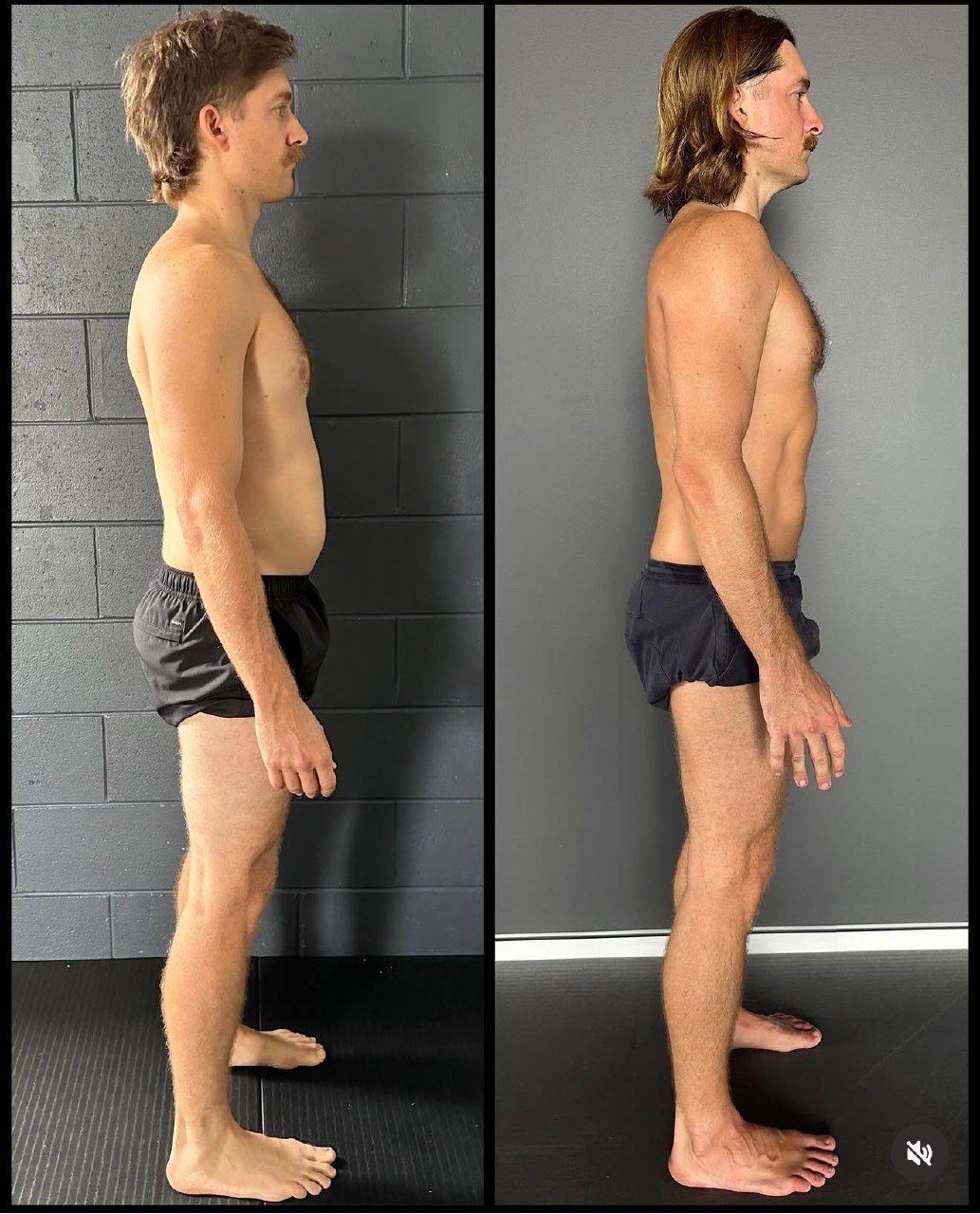 Why Stretching Isn’t Fixing Your Tight Muscles (And Can Make Things Worse)