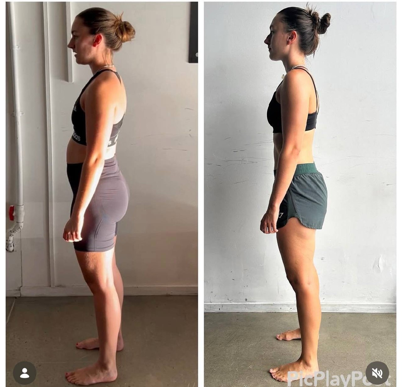 Why Stretching Isn’t Fixing Your Tight Muscles (And Can Make Things Worse) — image 3