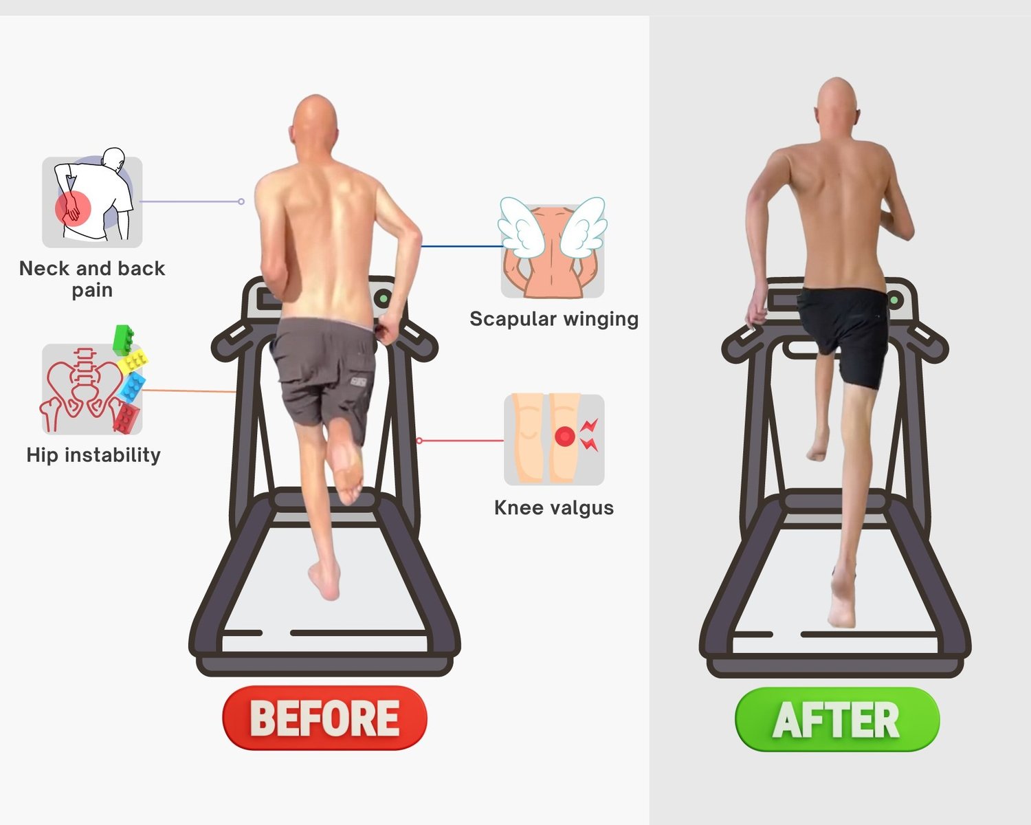 Why You Experience 'Unexplained' & Ongoing Pain.