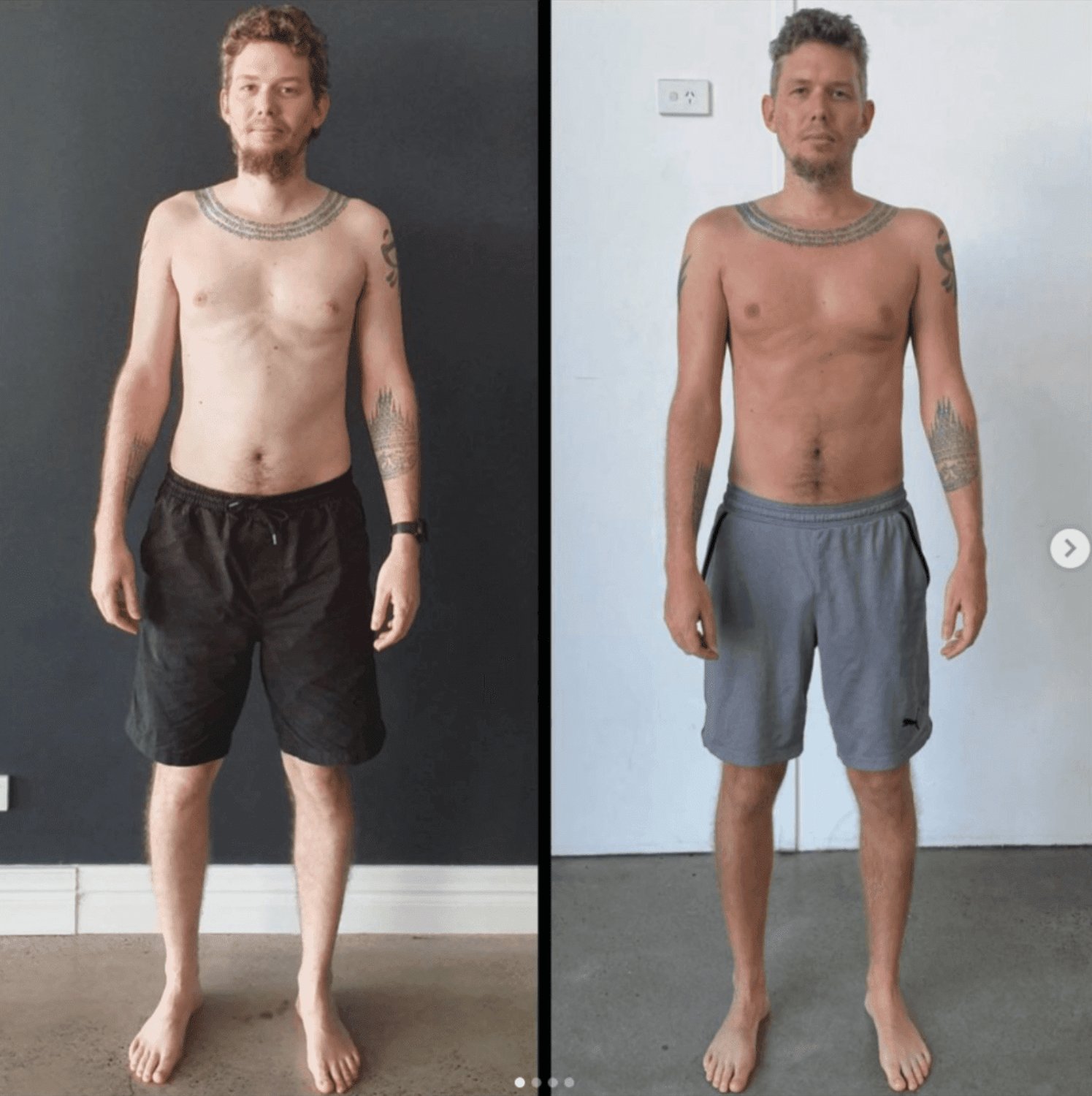 Why You Need Daily Sunshine To Be Healthy: Biomechanics & Skin Cancer