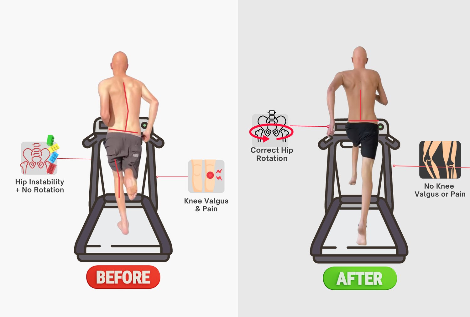 Why Your Knees Always Hurt - Hip Rotation, Gait Cycle, and Knee Pain