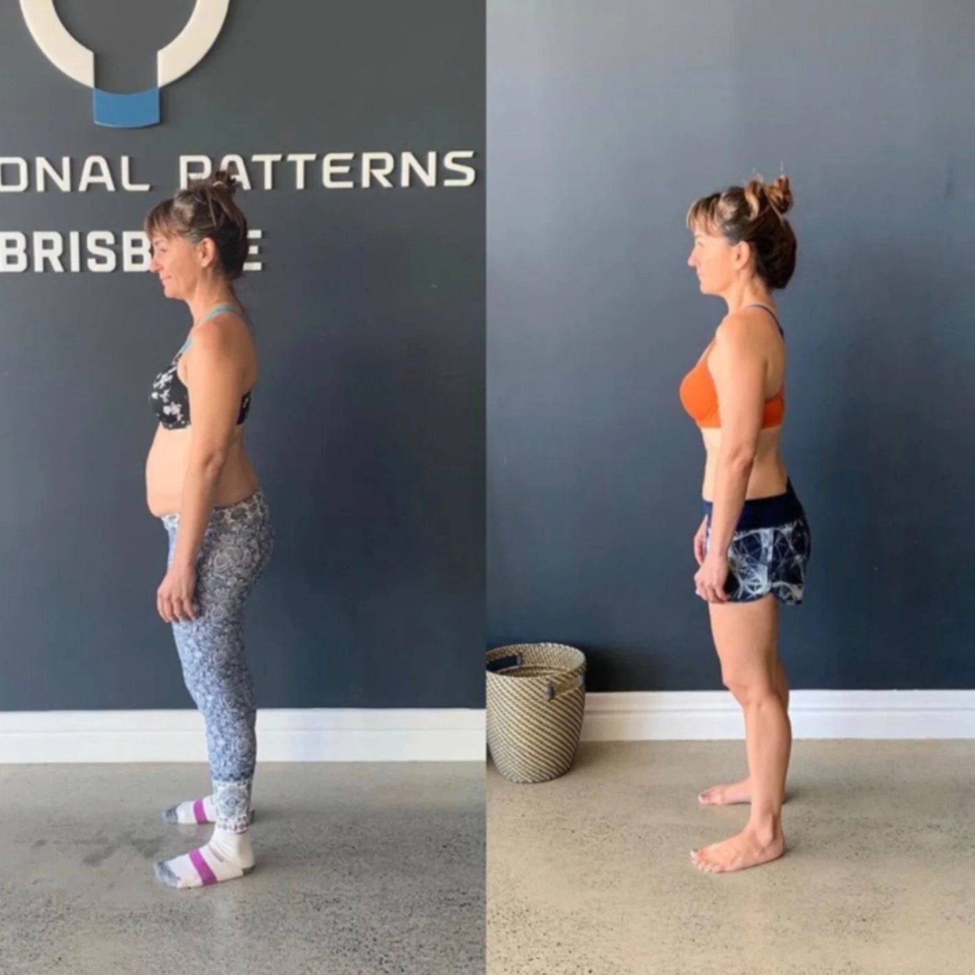 Why Your Rounded Shoulders Keep Coming Back – And What to Do Instead