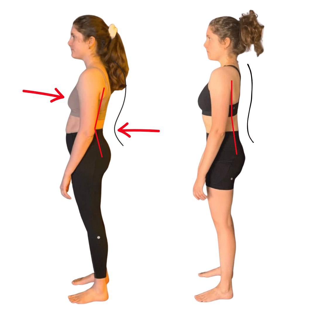 Will You Have To 'Force' Good Posture Forever? Or Can Posture Changes Feel Natural.