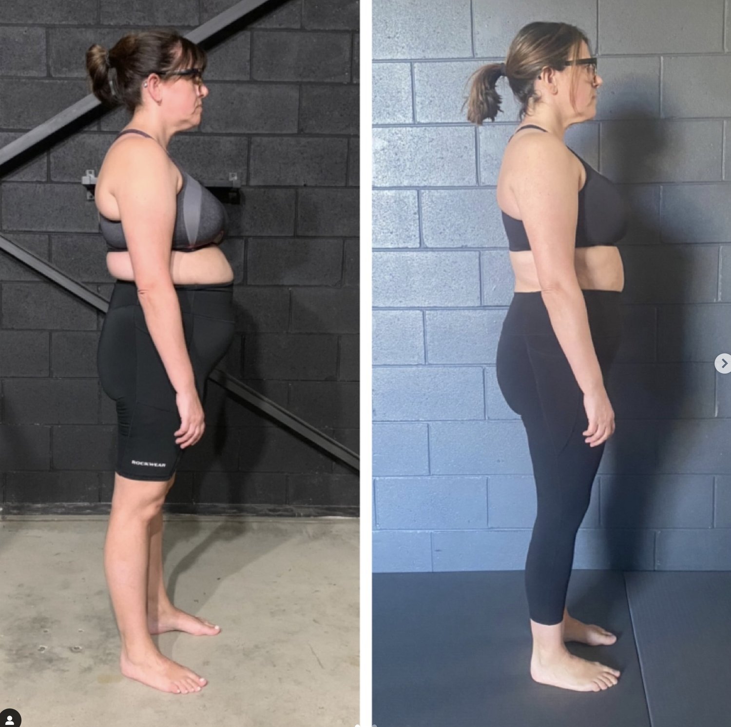 how to fix poor posture