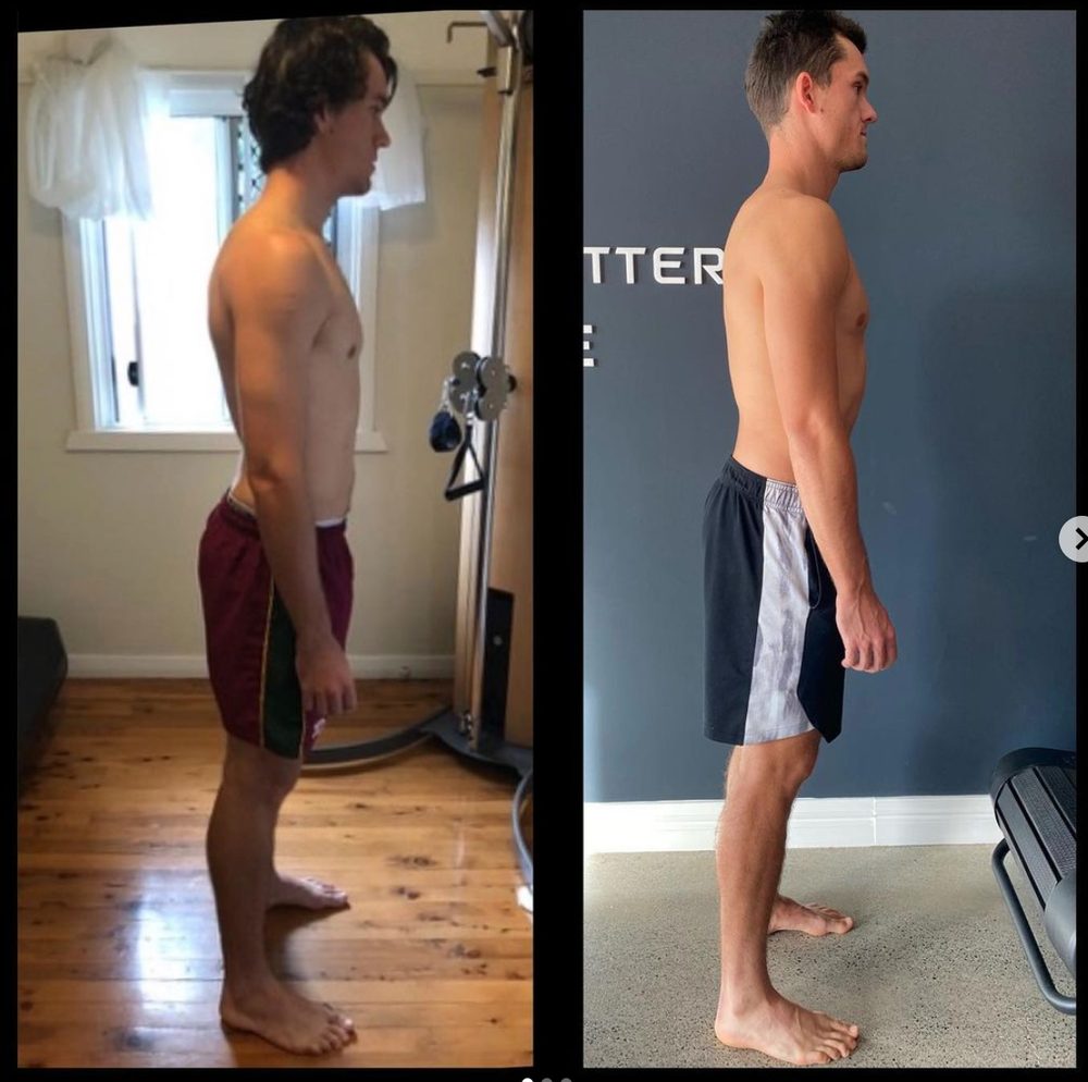 2 years chronic groin and lumbar pain reversed — Functional Patterns Brisbane