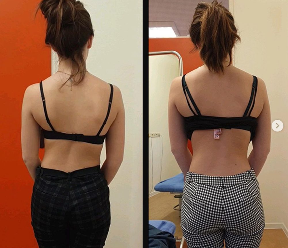 What Happens When People Focus On Fascia? — Functional Patterns Brisbane