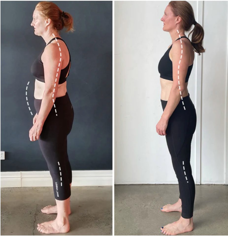 posture specialist brisbane — Functional Patterns Brisbane
