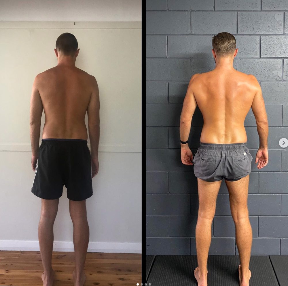 How Does Natalie Feel About Her Scoliosis & Posture Trans... — Functional Patterns Brisbane