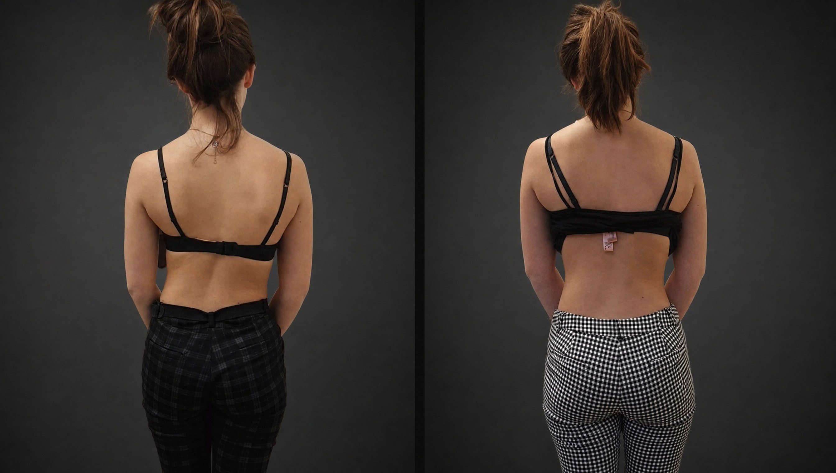 Before and after posture transformation &mdash; back view, after Functional Patterns training.