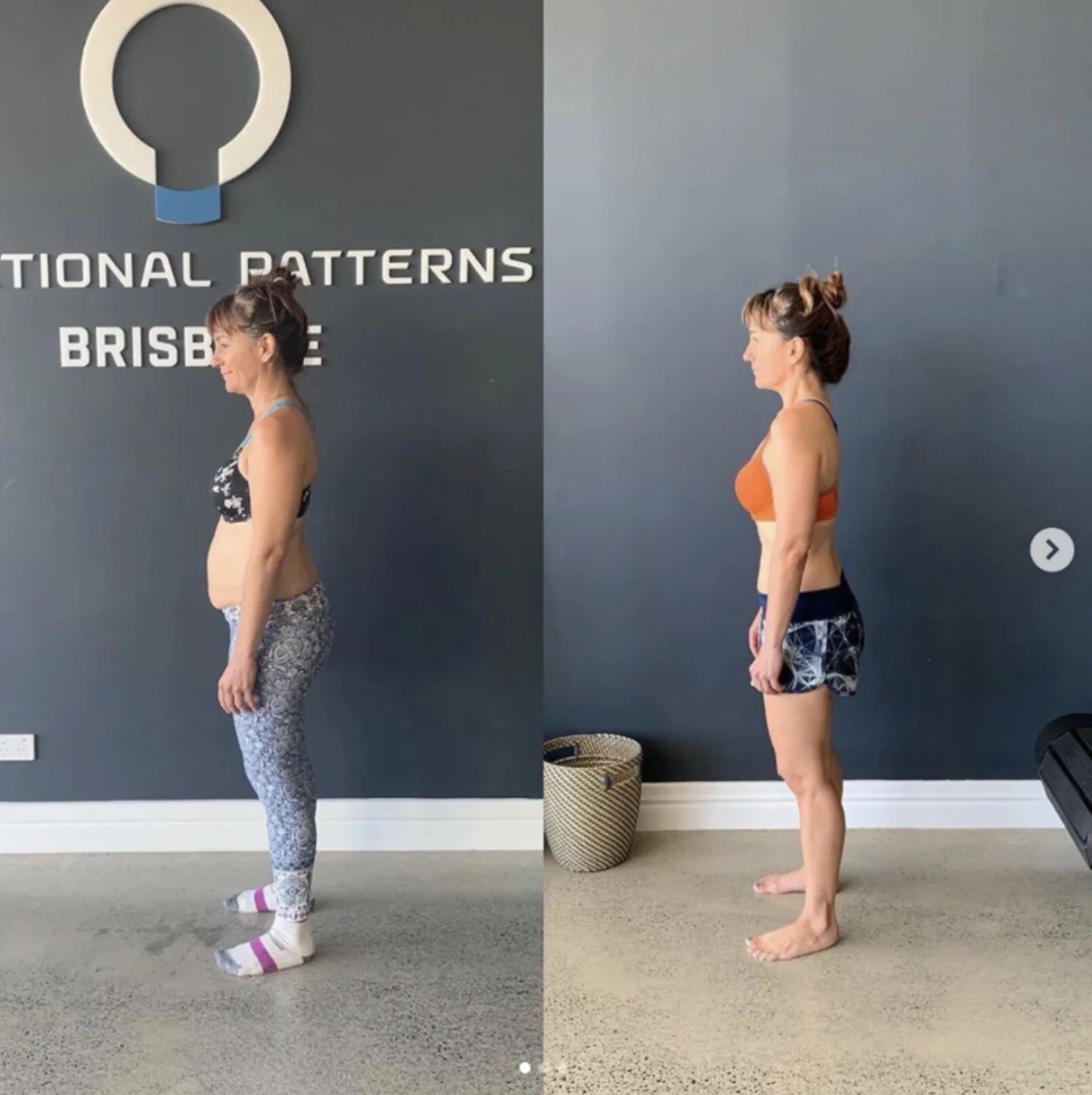 Transform Your Posture at Functional Patterns Brisbane